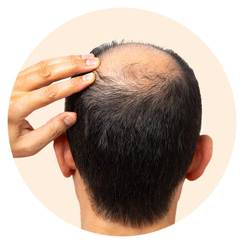 Can Shampoo Help With Hair Growth? Discover the Truth!