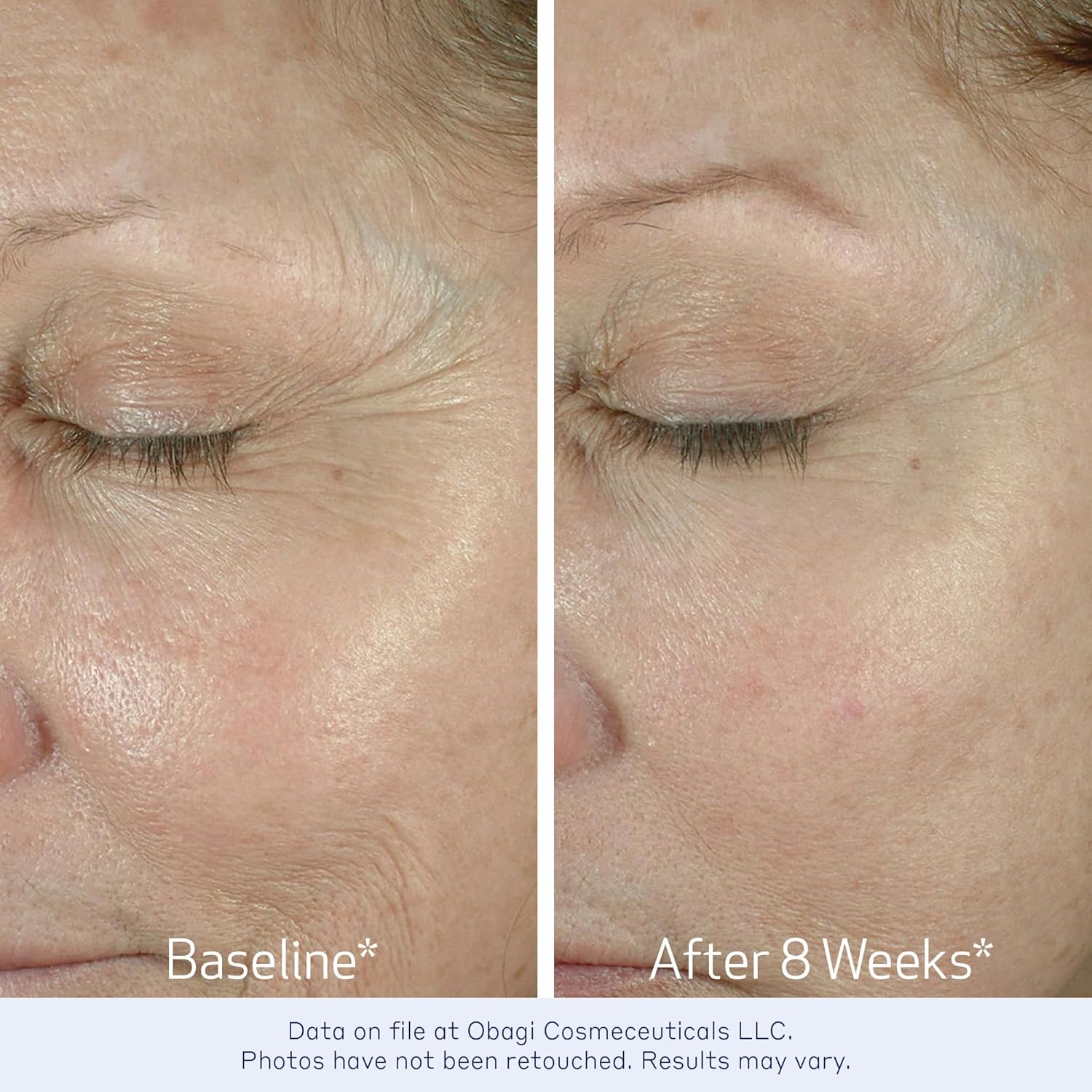 Elastiderm Eye Cream – Unlock Radiant Eyes with Advanced Anti-Aging Formula