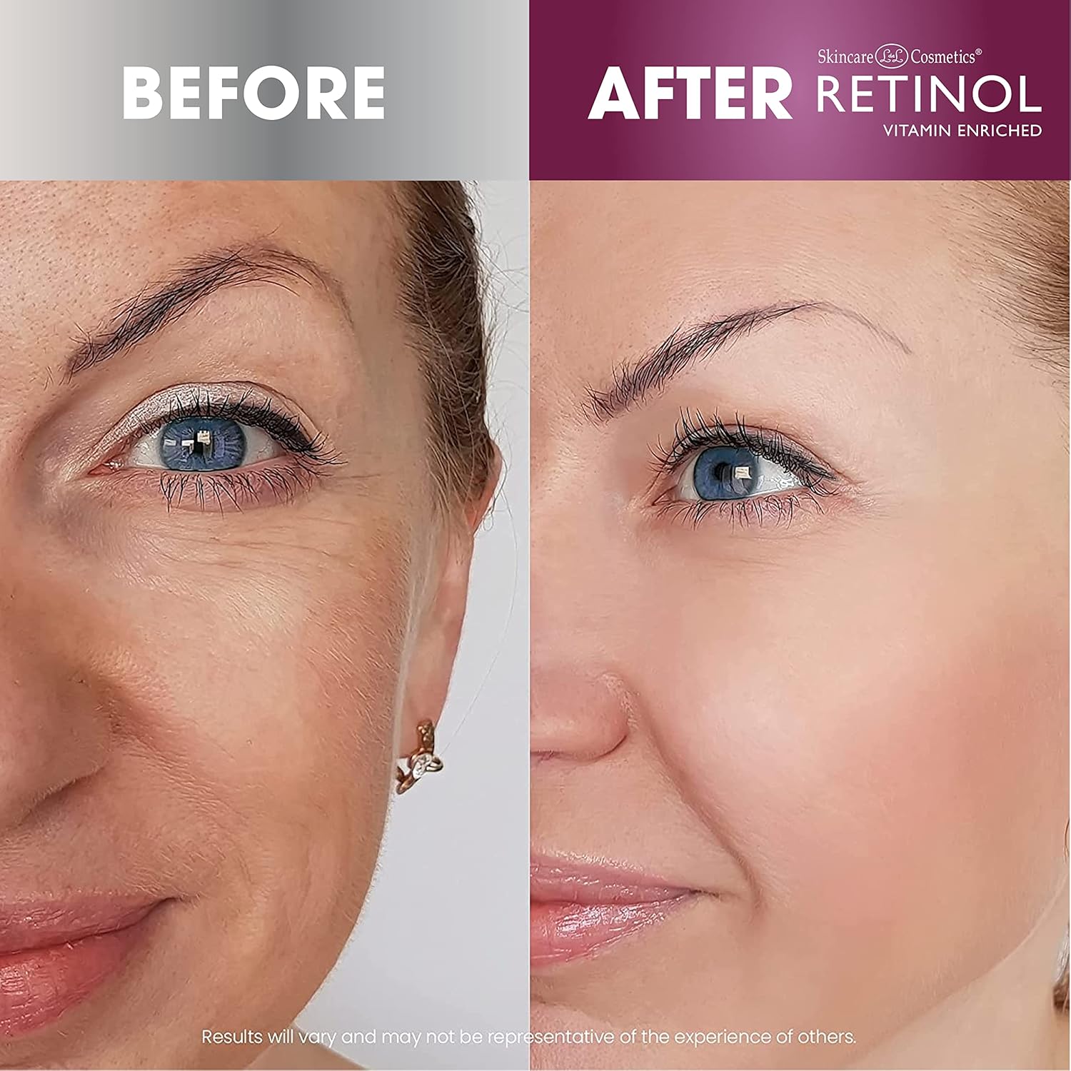 Retinol Complex Serum 6% – Transform Your Skin Overnight with Advanced Renewal