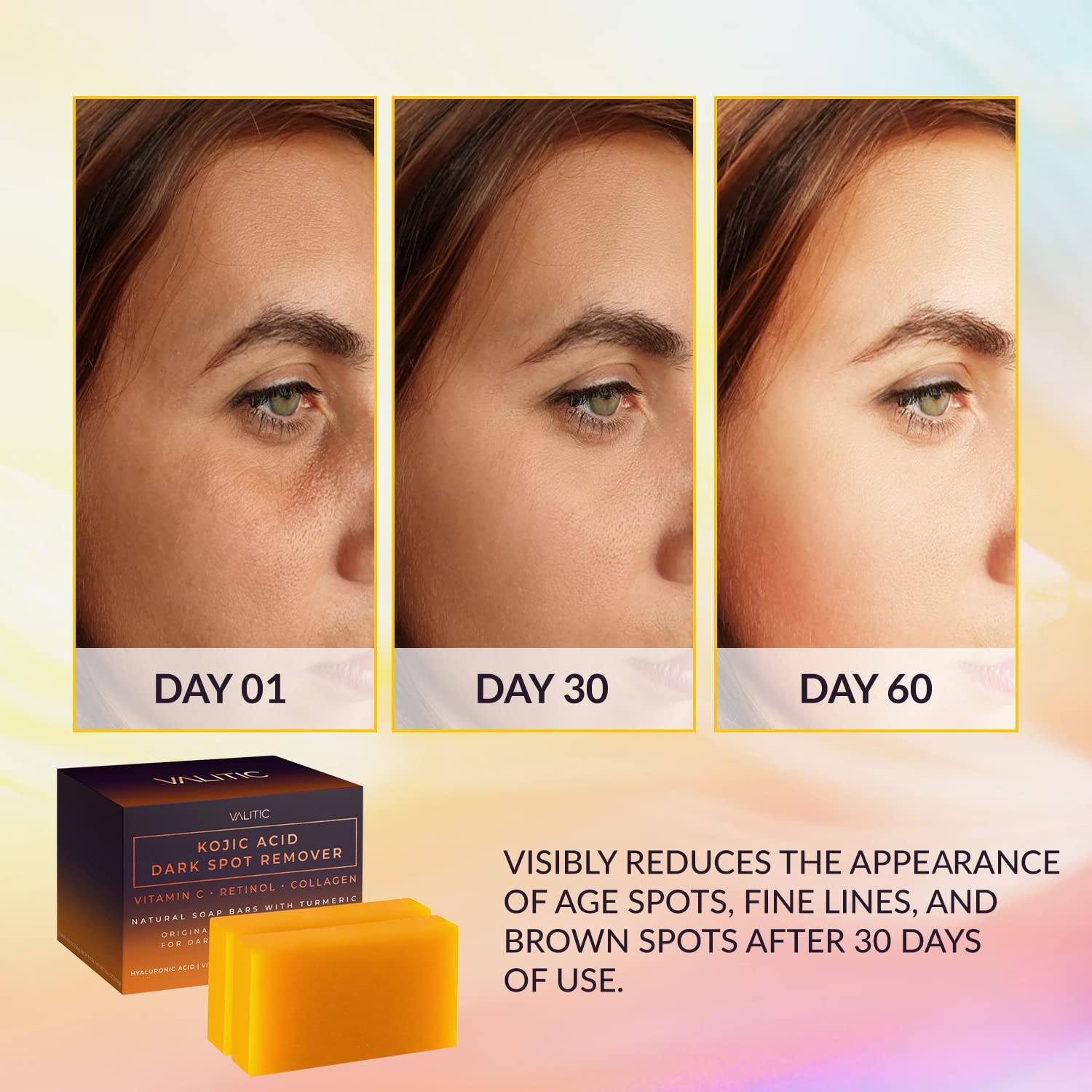 Valitic Kojic Acid Dark Spot Remover Soap – Transform Your Skin Today!